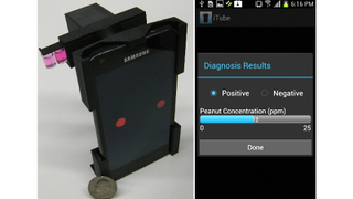 Smartphone Analyzer Can Spot Ingredients You Might Be Allergic To